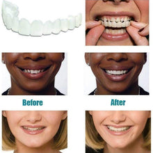 Load image into Gallery viewer, Magic Teeth Brace!
